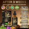 TOOYES® MetaBoost GLP-1 Herbal Oral Liquid