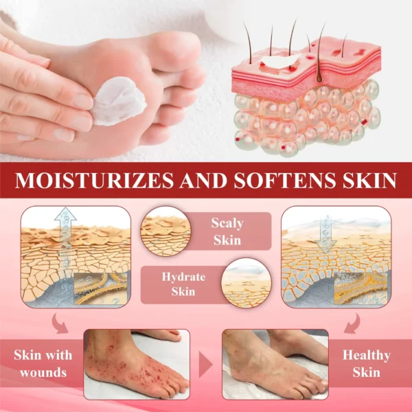 BBOJI™ GlucoseGuard Skin Rescue Cream