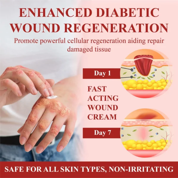BBOJI™ GlucoseGuard Skin Rescue Cream