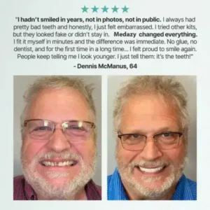 Medazy™ Custom-Fit Full Functional Dentures