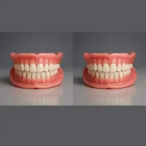 NESLEMY™ Custom-Fit Functional Dentures – Perfectly Fitted in Minutes at Home