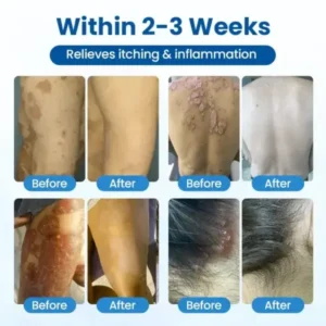 Cougex® PCA Magnesium Deep Repair Spray